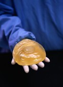 implant